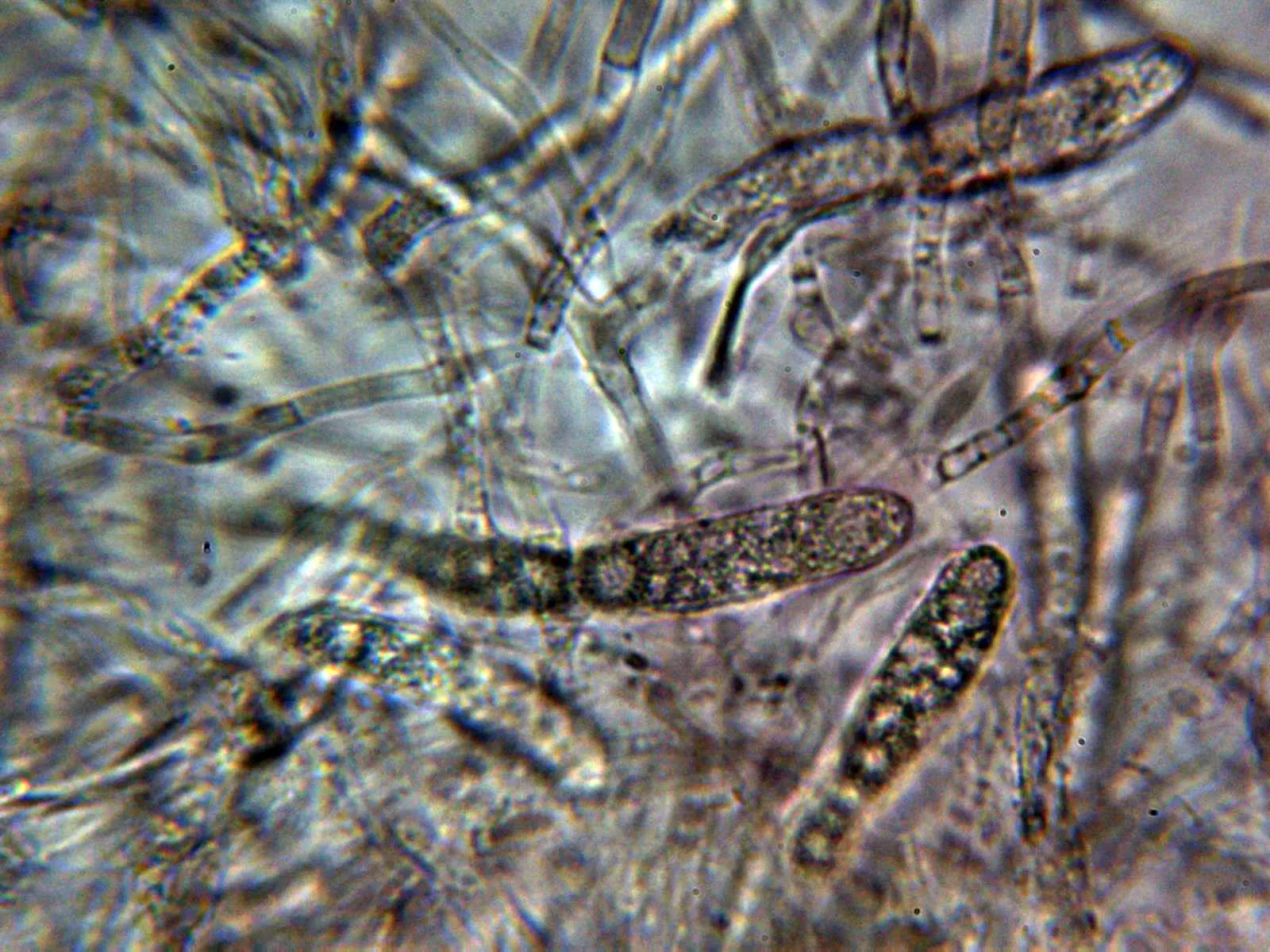 Microscopía de Russula firmula - 10 - Dermatocistidios 1